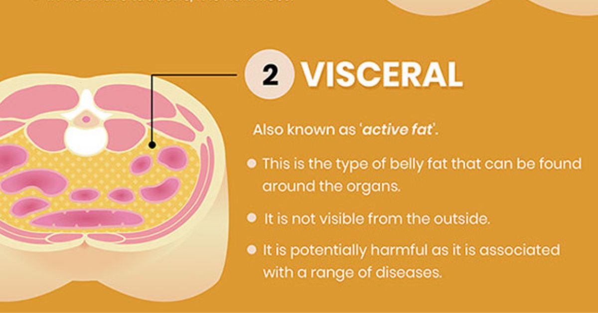 visceral fat